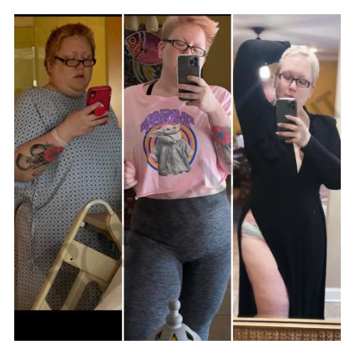Ashley B - 6 Month Update*